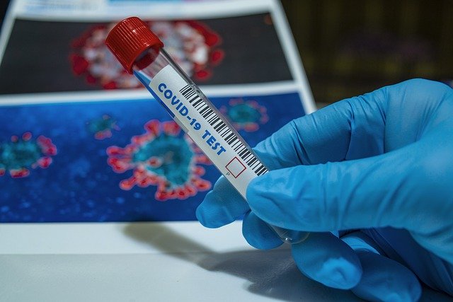 850 случаев коронавируса зарегистрировали в Приамурье на прошлой неделе