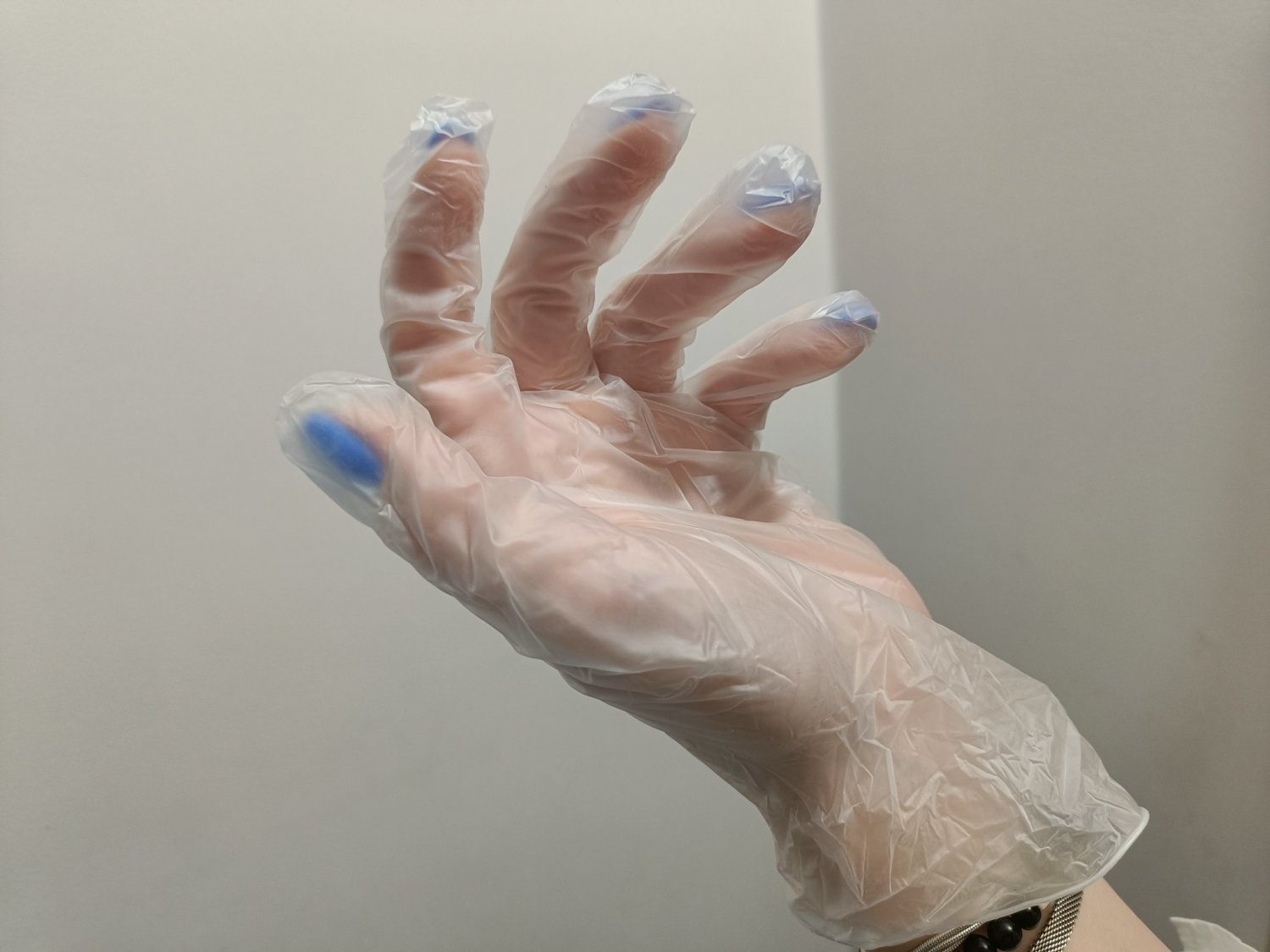 Карантин по бешенству снят в селе Белогорского округа