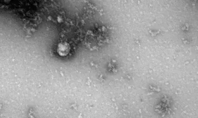 "Британский" штамм коронавируса впервые в мире сфотографировали российские ученые