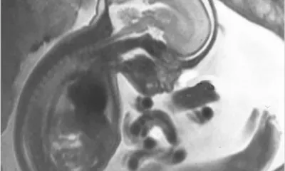 Впервые в Забайкалье специалисты Клинической больницы «РЖД-Медицина» города Чита выполнили МРТ плода 