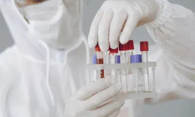 678 случаев коронавируса зарегистрировали в Приамурье за неделю