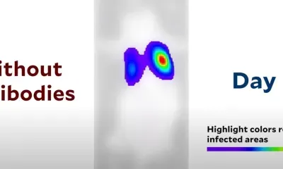 Как коронавирус распространяется в организме, показали ученые на видео