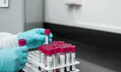 Самый точный экспресс-тест на коронавирус разработал Роспотребнадзор