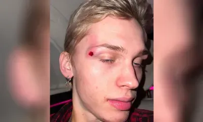 Даня Милохин попал под колеса велосипеда в центре Москвы