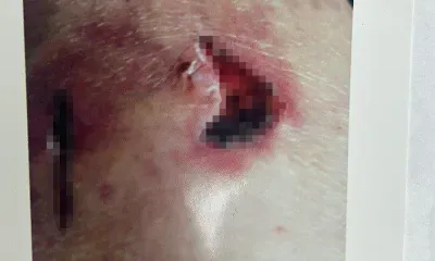 Плату за страдания получит жертва агрессивной собаки с биркой