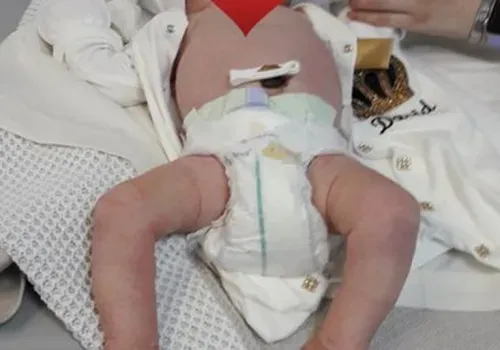 Врачи АОКБ избавили младенца от редкой патологии
