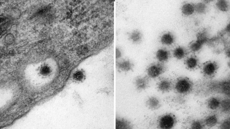 Фото "дельта"-штамма коронавируса впервые опубликовал Центр "Вектор"