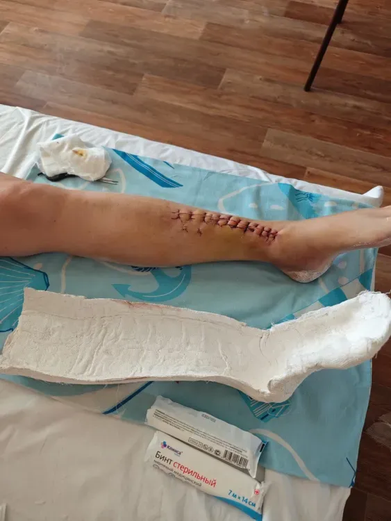 Торговый центр выплатил компенсацию беременной амурчанке после падения